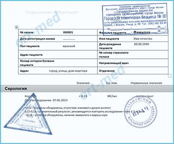 Купить справку тест на антитела к вирусу кори в Красногорске официально